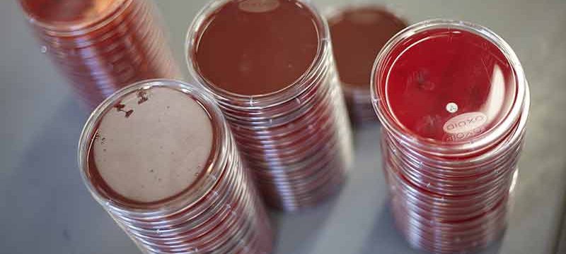 Collection of petri dishes with red agar