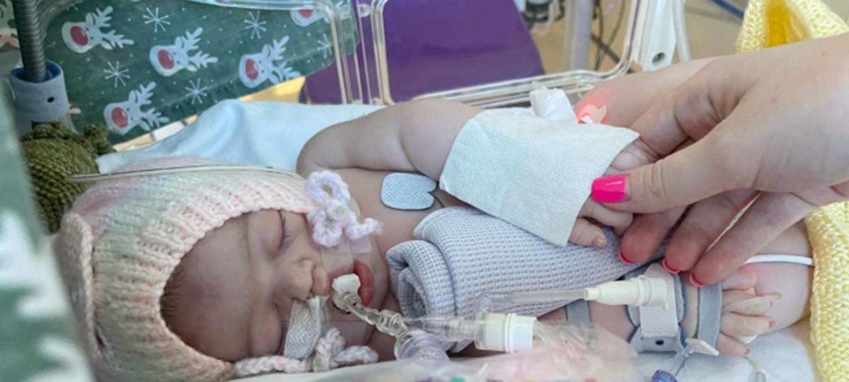 A small baby with a breathing tube lies in a hospital incubator holding a hand.