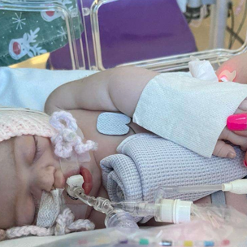 A small baby with a breathing tube lies in a hospital incubator holding a hand.