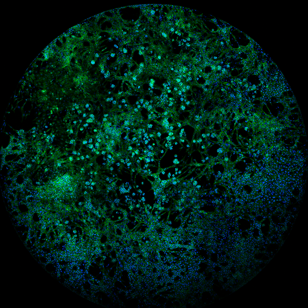 Circular microscopic-style image showing a dense pattern of green and blue speckled structures against a black background