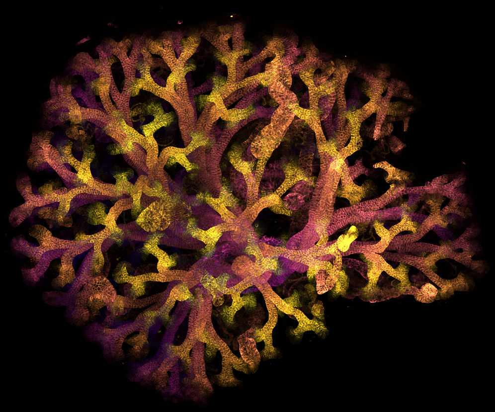 Fluorescent microscopic image showing a branching, tree‑like structure in shades of yellow, orange and purple against a black background