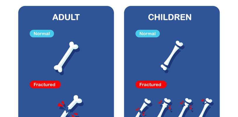 A diagram highlighting the differences between fractures in adults and children - with fractures in children presenting in multiple different and less obvious ways