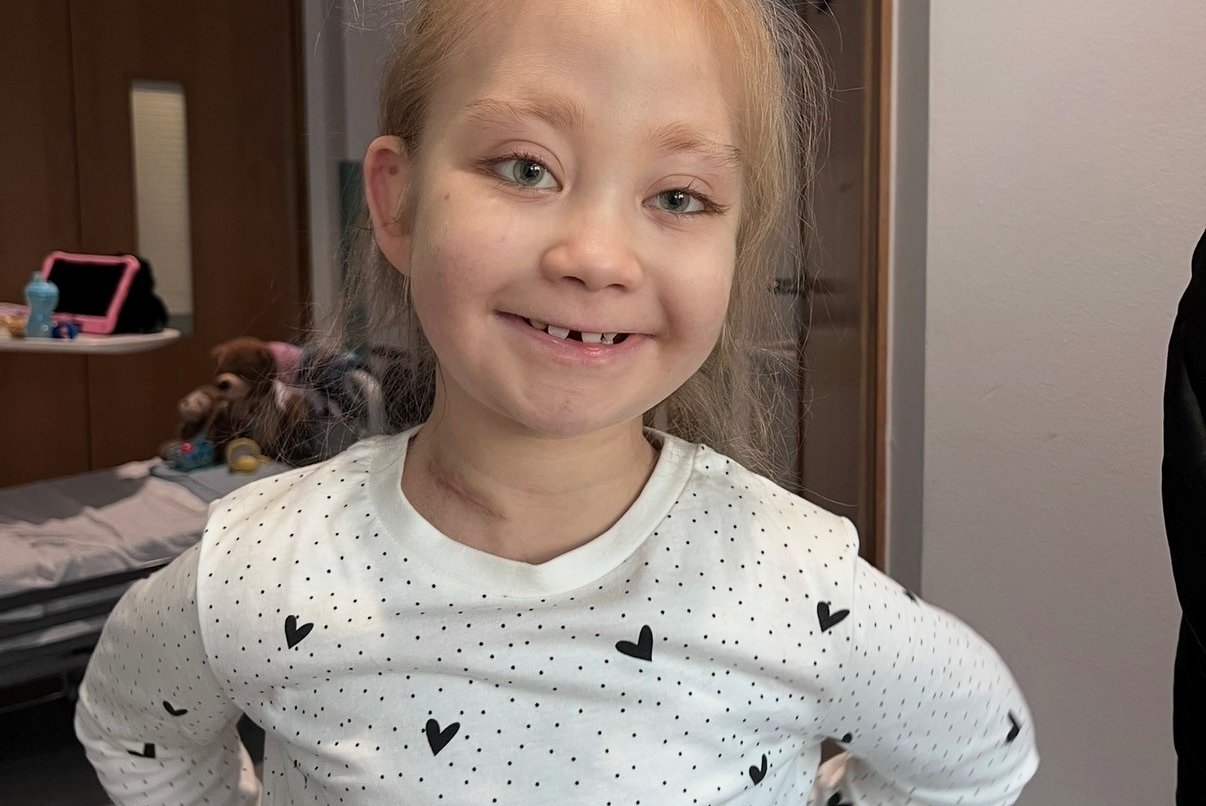 A young girl smiles at the camera - she looks well
