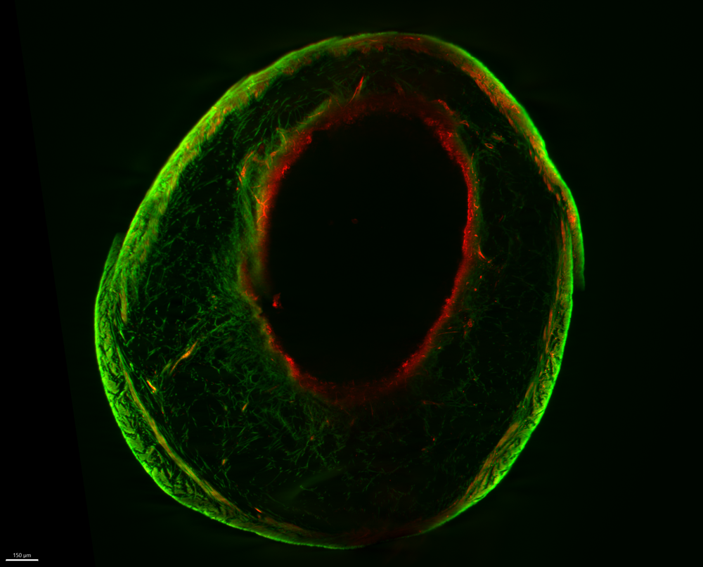 Fluorescent microscopic image showing a circular tissue structure with a dark central opening, outlined by red fibres and surrounded by a green outer layer