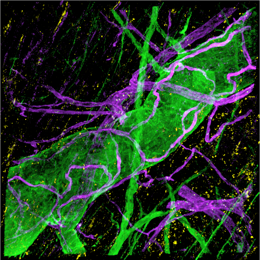 Fluorescent microscopic image showing intertwined green and purple branching structures, overlaid with small scattered yellow points on a black background.