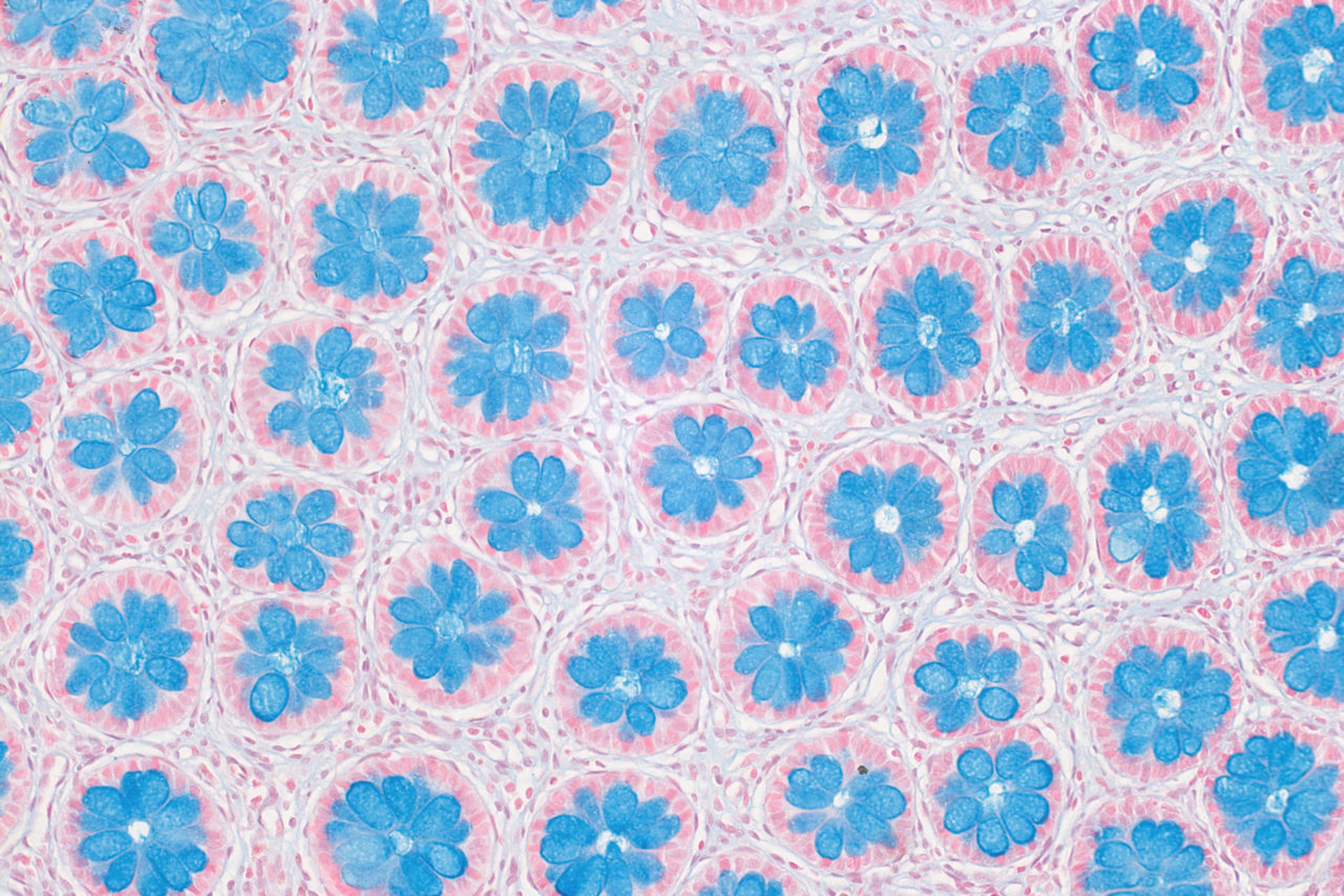 Lucy's image competition entry entitled 'blooming barrier'