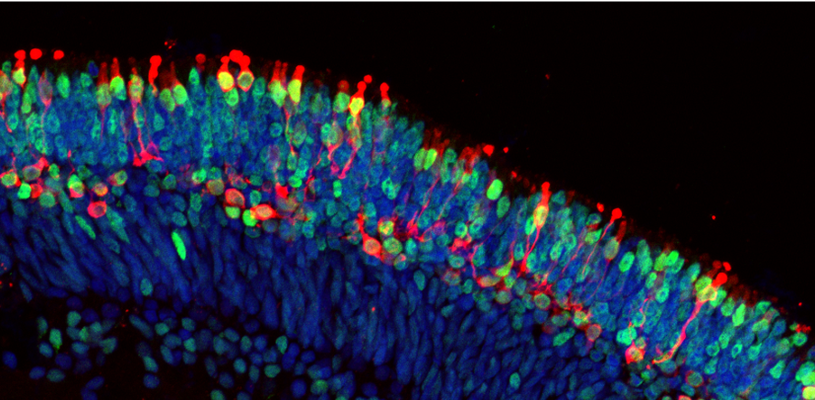Image of rod cells in the retina of the 'mini eyes'