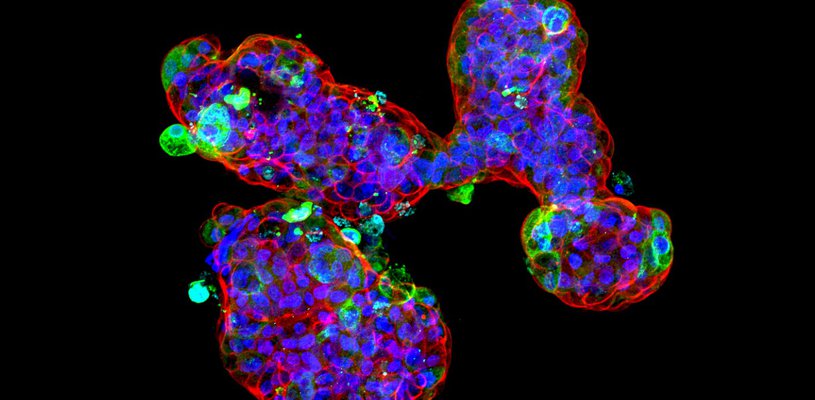 A microscopic image of the mini stomachs.