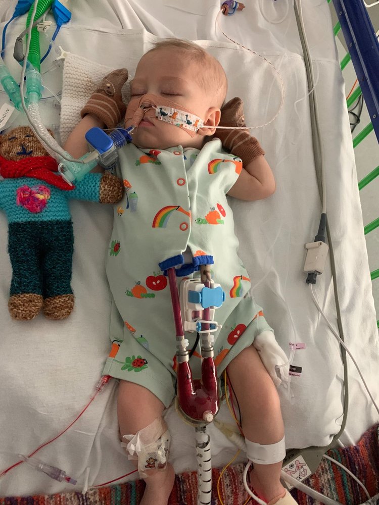 A baby sleeping in a hospital cot. They are laid on their back and have a berlin heart machine attached to them. The baby is wearing a colourful Baby grow and has a teddy bear next to them.