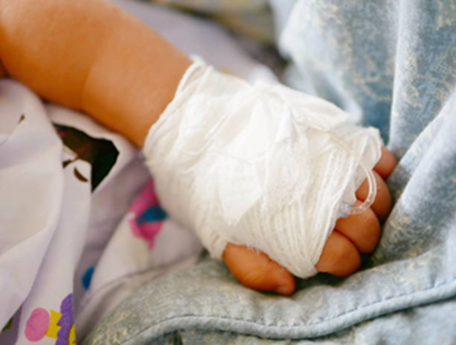Close-up of a small child's hand wrapped in white bandages, resting on light blue and white bedding.