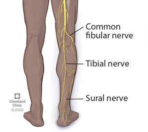 Image showing the sural nerve- a nerve which runs down the leg