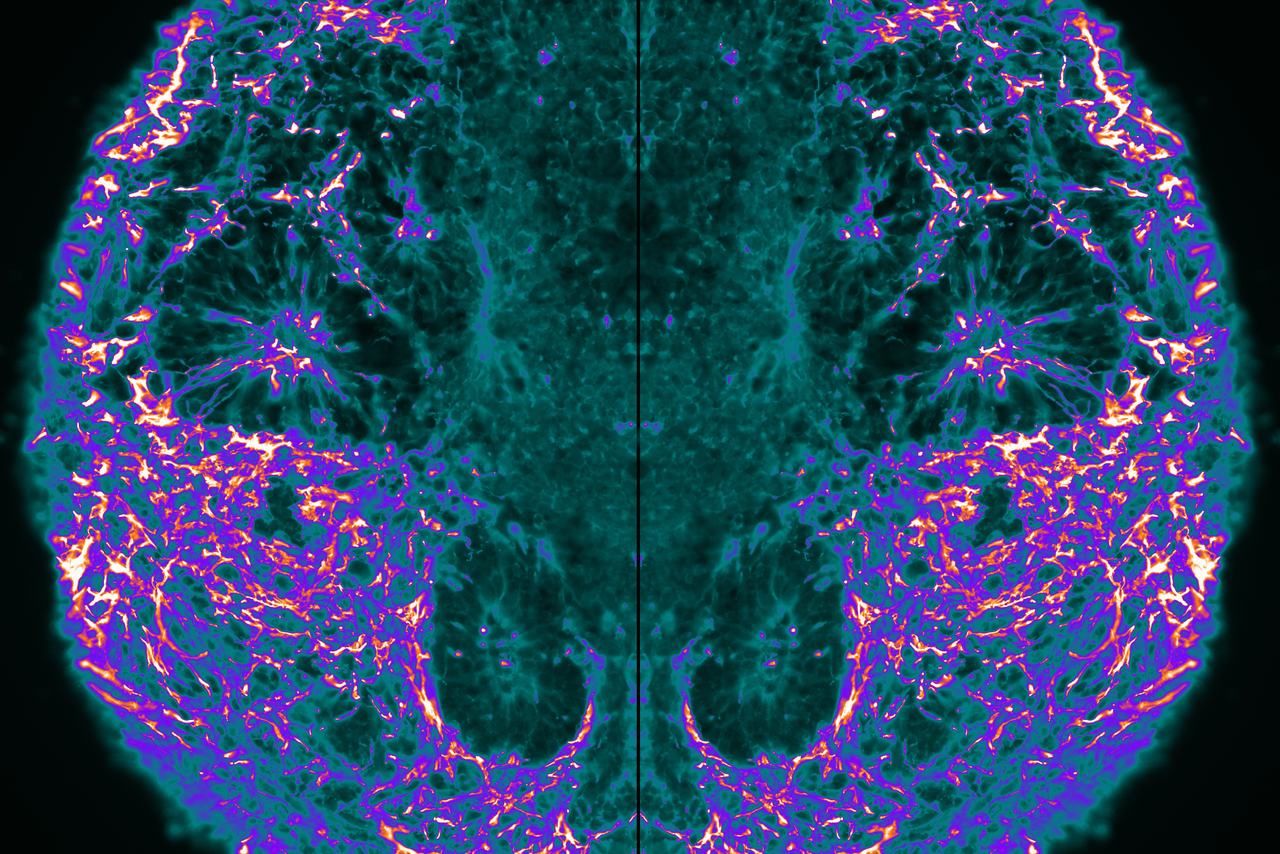 Reem's entry to the image competition showing an image of a brain organoid.
