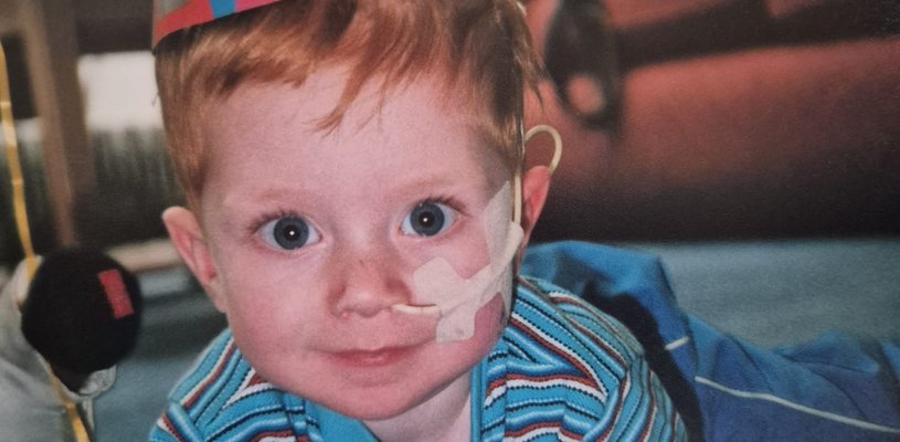 Young boy lying on front wearing a party hat with number 1 on it, smiling, with medical tube in nose.