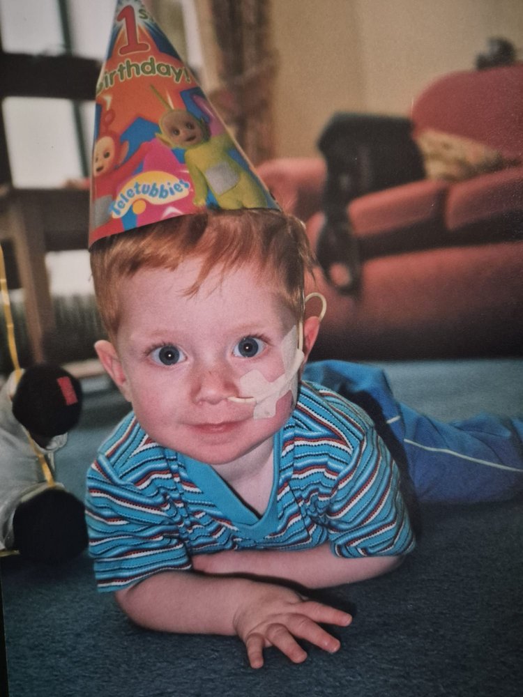 Young boy lying on front wearing a party hat with number 1 on it, smiling, with medical tube in nose.