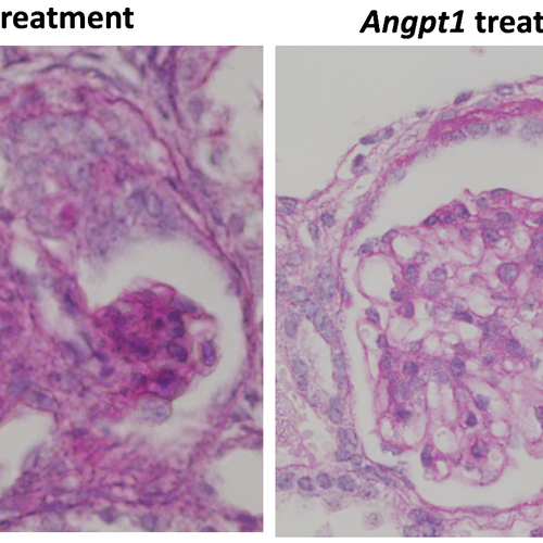 PAS (periodic acid–Schiff) stained glomeruli showing reduced scarring (deep pink) following ultrasound guided renal artery injection of Angpt1 nanocomplexes.