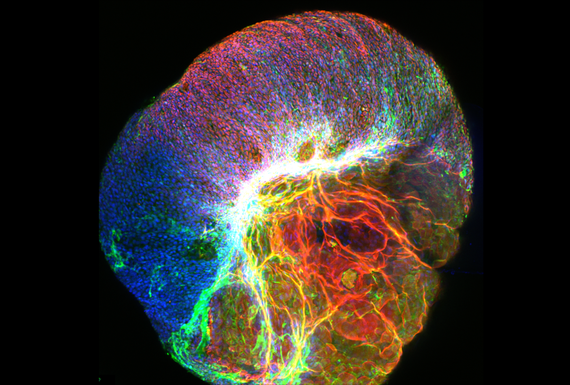 This image shows an exploding colourful ball, the outside is coloured pink, blue and green and the inside is red, yellow and green. The ball is a gut ‘mini-organ’, known as an organoid, and it is a tiny copy of the digestive system.