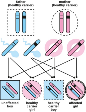 Diagram showing X-linked inheritance- boy