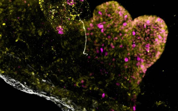 Mini stomach organoid