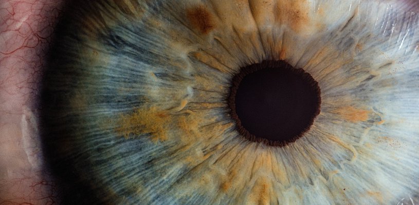 A close up photo on an eye.